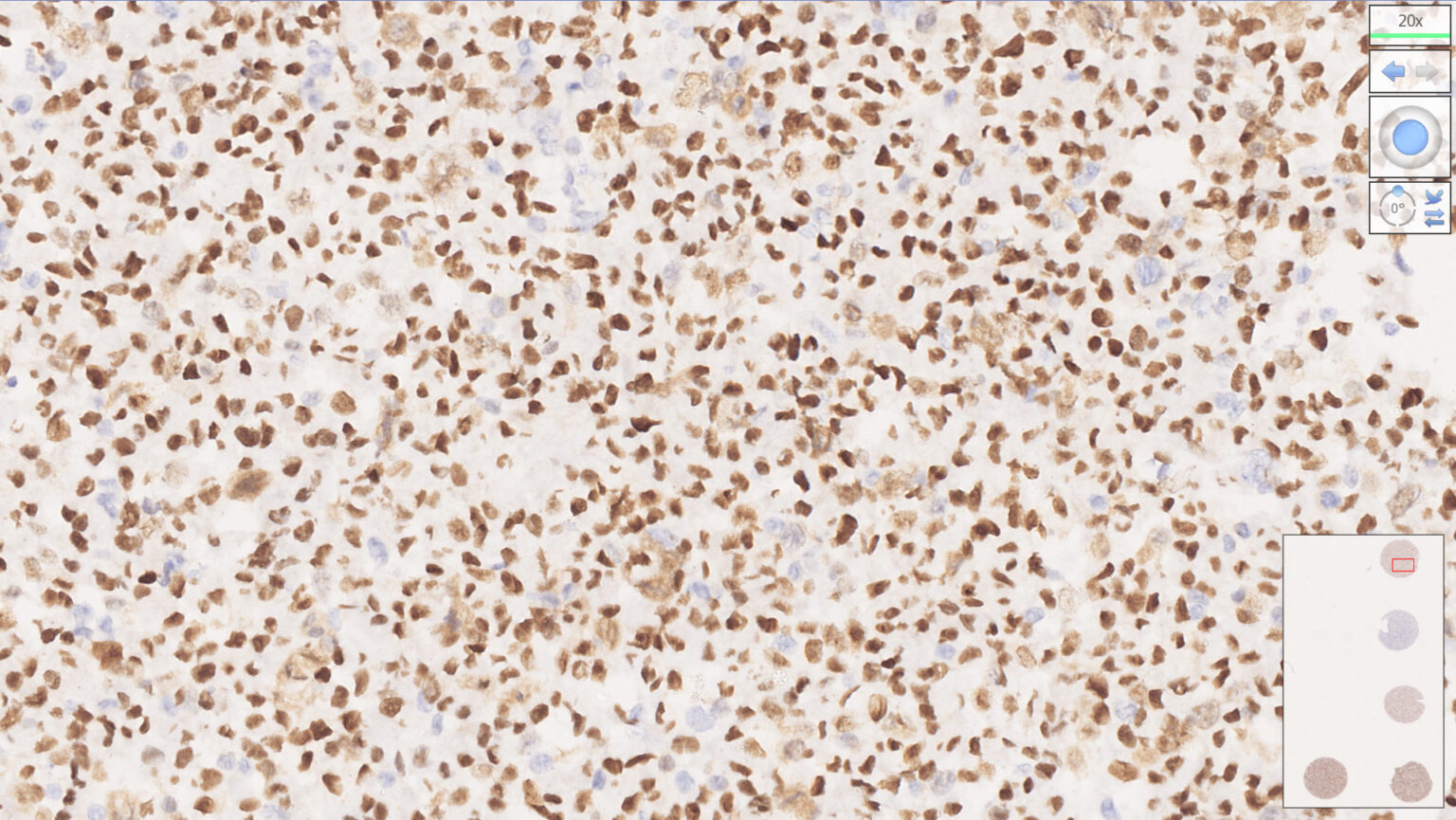 MMR Analyte Control - HistoCyte