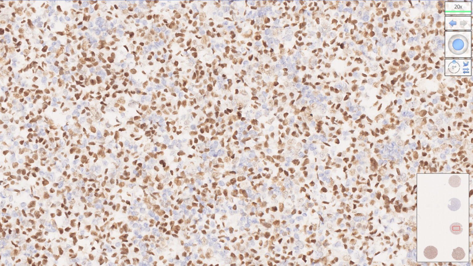 MMR Analyte Control - HistoCyte