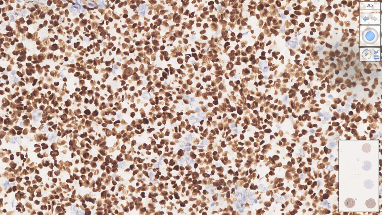 MMR Analyte Control - HistoCyte