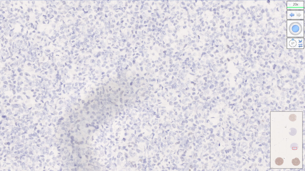 MMR Analyte Control - HistoCyte