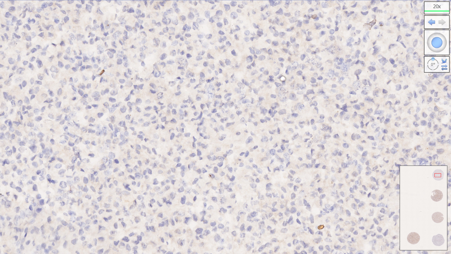 MLH1/PMS2 Analyte Control - HistoCyte