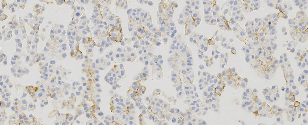 Breast Analyte ControlDR - HistoCyte