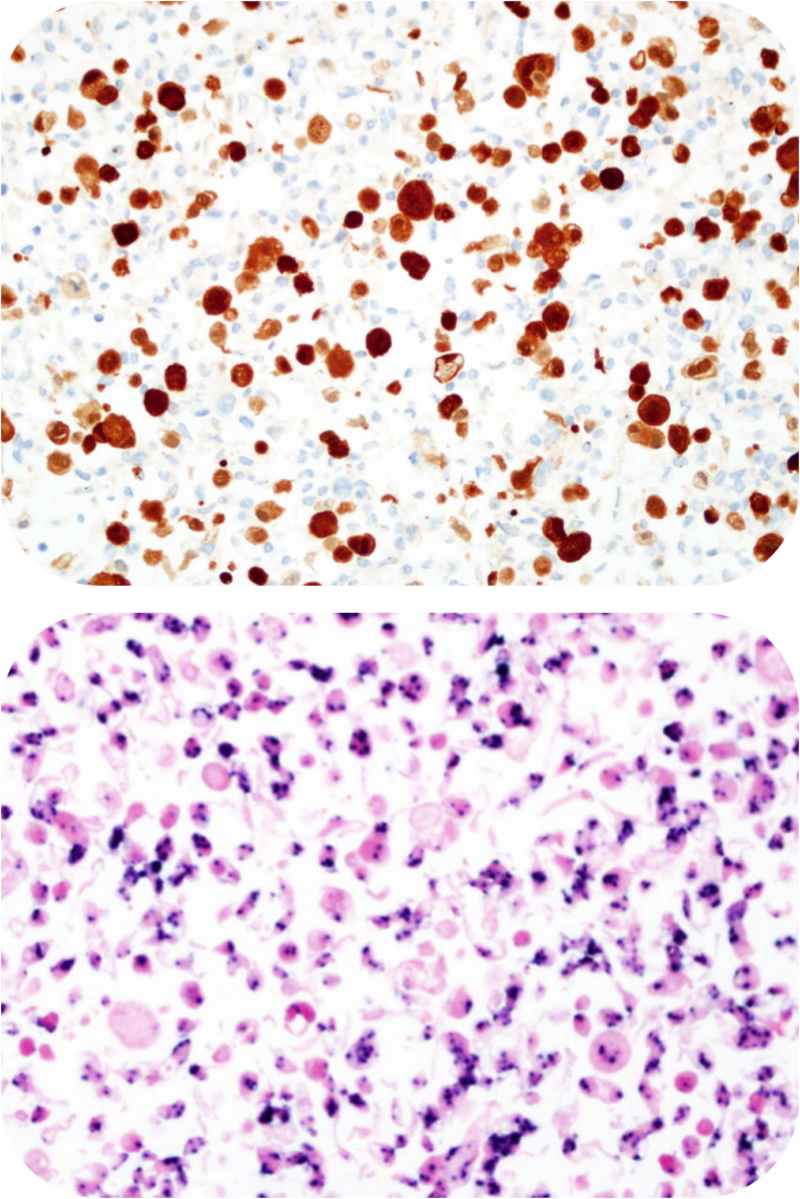 Dynamic range controls archives histocyte