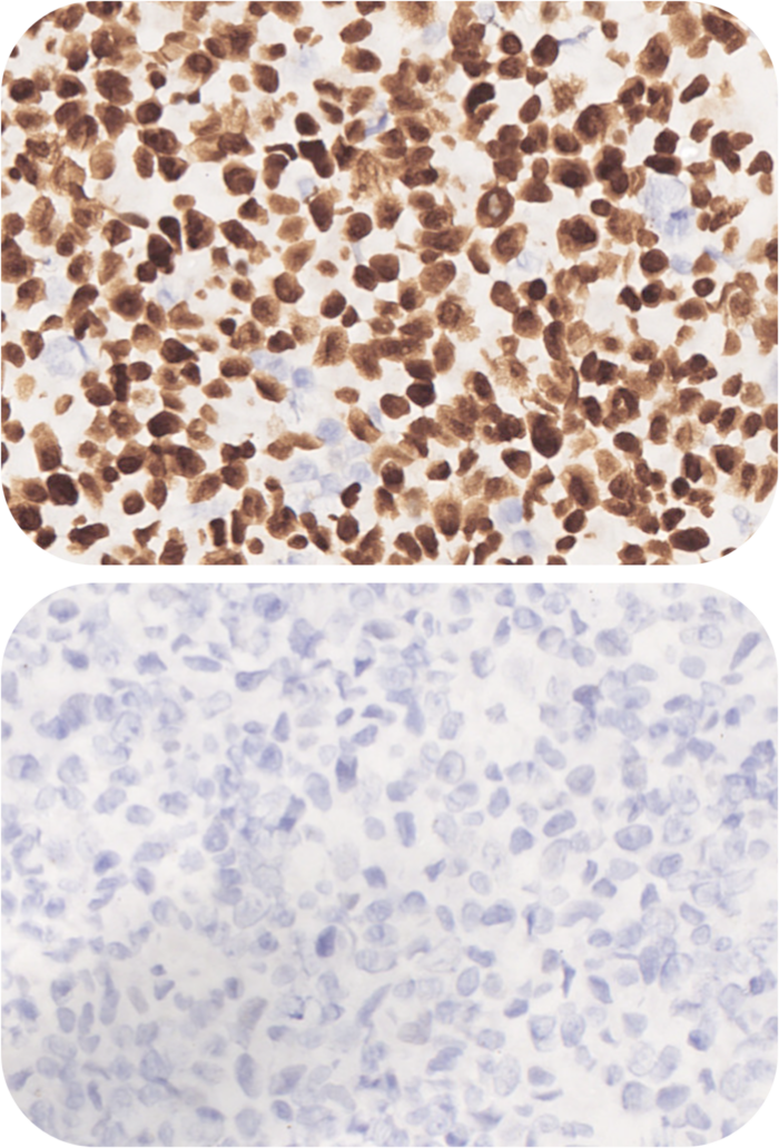 MSH2 Analyte Control HistoCyte